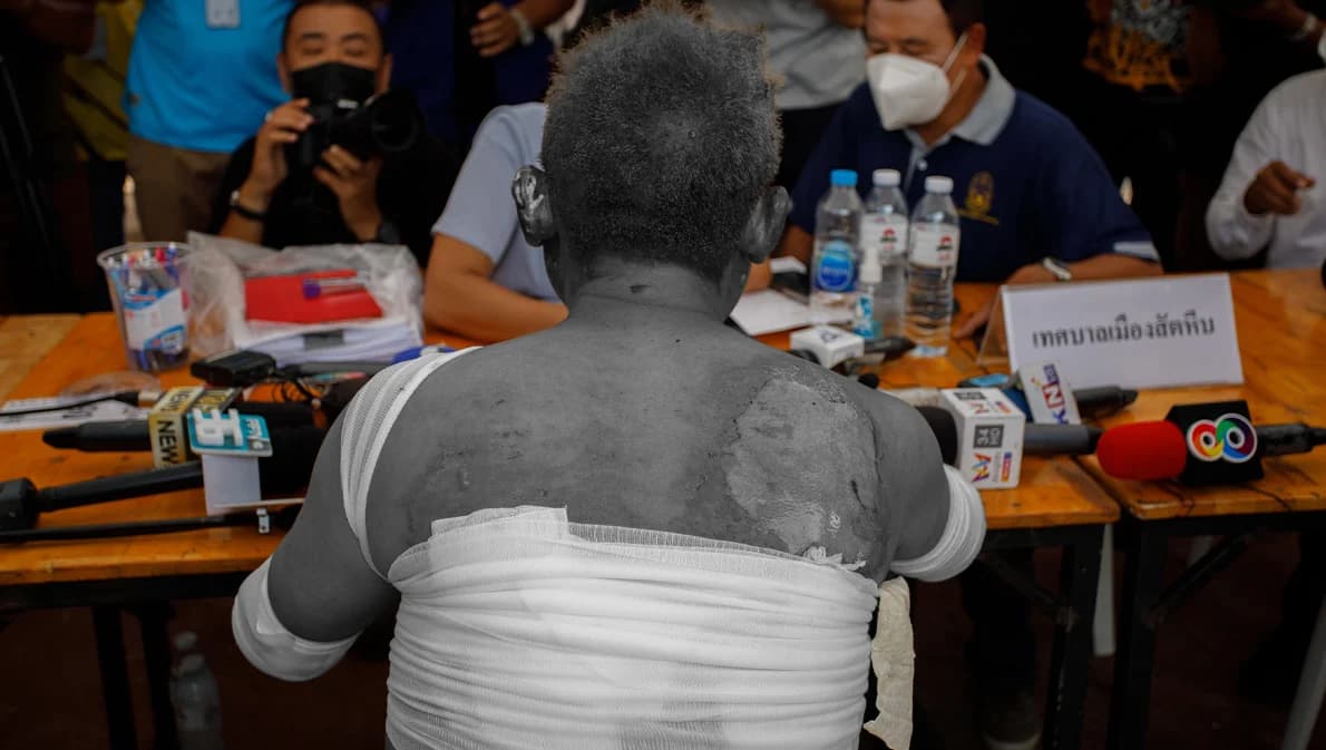 เหยื่อไฟไหม้ ‘เมาท์เทน บี’ เผยนาทีหนีเอาชีวิตรอดจากกองเพลิง