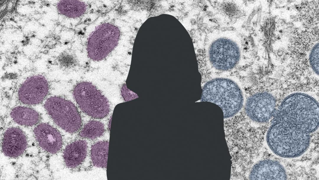 หญิงไทยอายุ 25 ปี ติดฝีดาษลิงเป็นผู้ป่วยยืนยันรายที่ 5 ของไทย