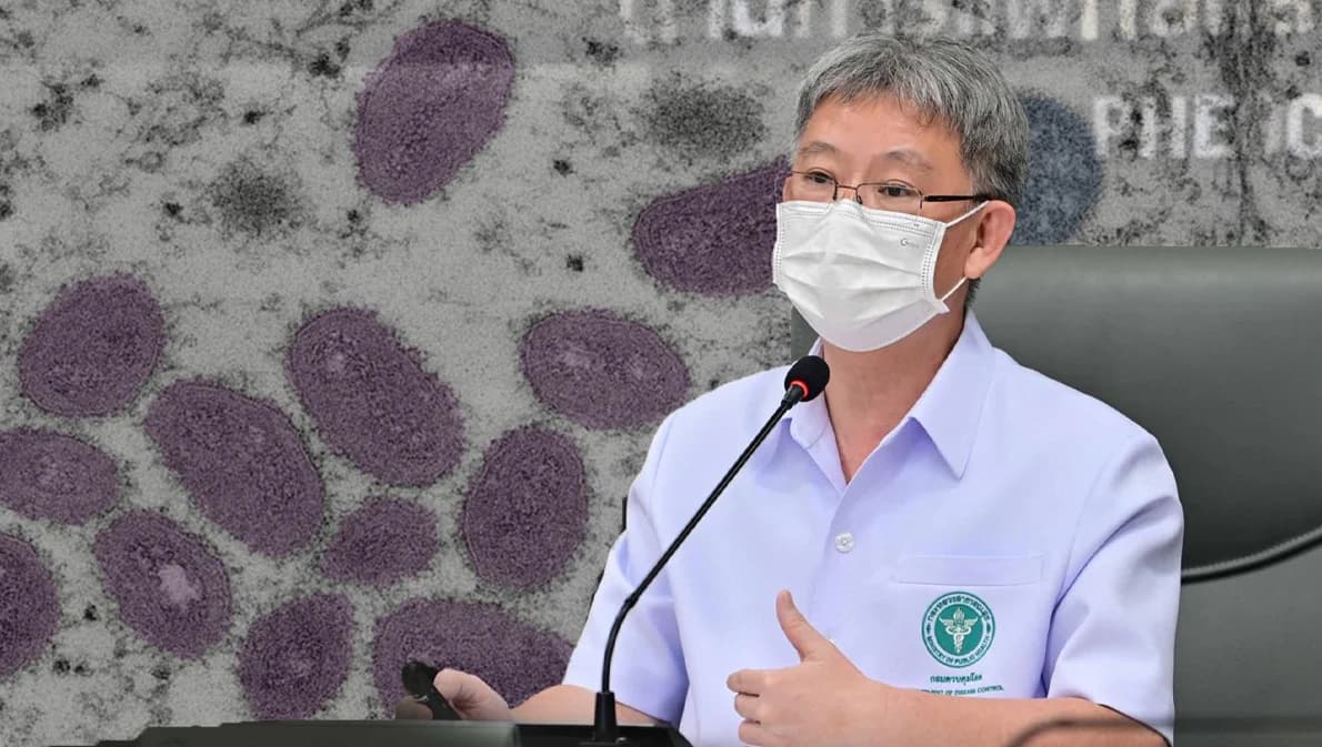 ‘ฝีดาษลิง’ ยืนยันรายที่ 7 เป็นหญิงไทยอายุ 37 ปี อยู่ในกรุงเทพฯ