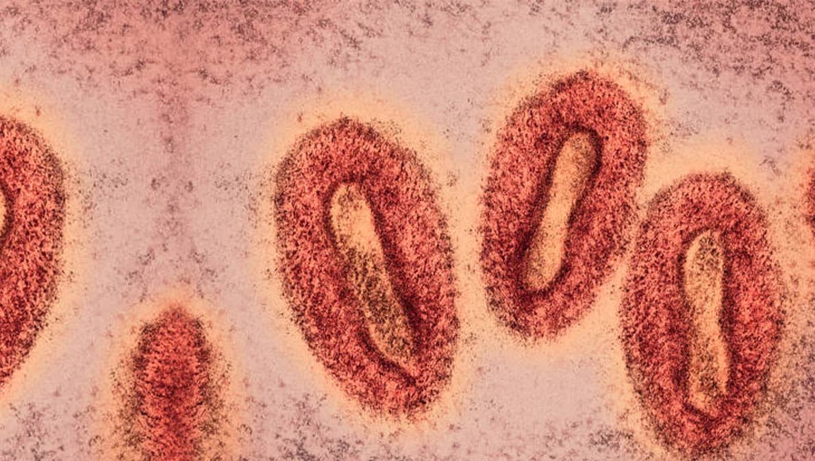 สธ.ลดระดับศูนย์ EOC ฝีดาษลิง หลังแนวโน้มผู้ป่วยลดลง