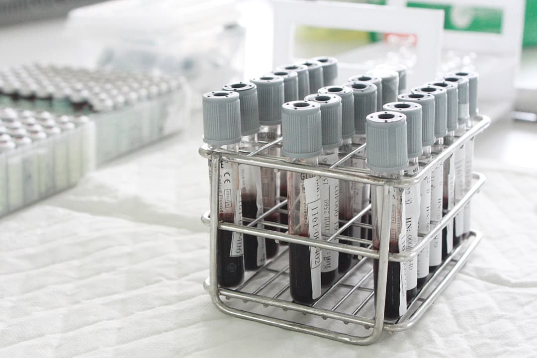 กรมวิทย์ฯ เปิดห้องปฏิบัติการ 15 แห่ง ตรวจ-วิเคราะห์แอลกอฮอล์ในเลือด