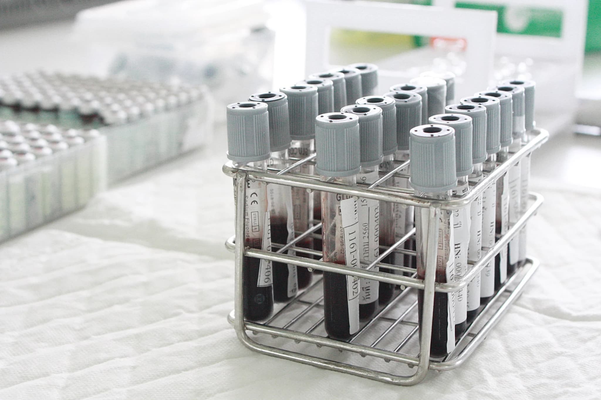 กรมวิทย์ฯ เปิดห้องปฏิบัติการ 15 แห่ง ตรวจ-วิเคราะห์แอลกอฮอล์ในเลือด