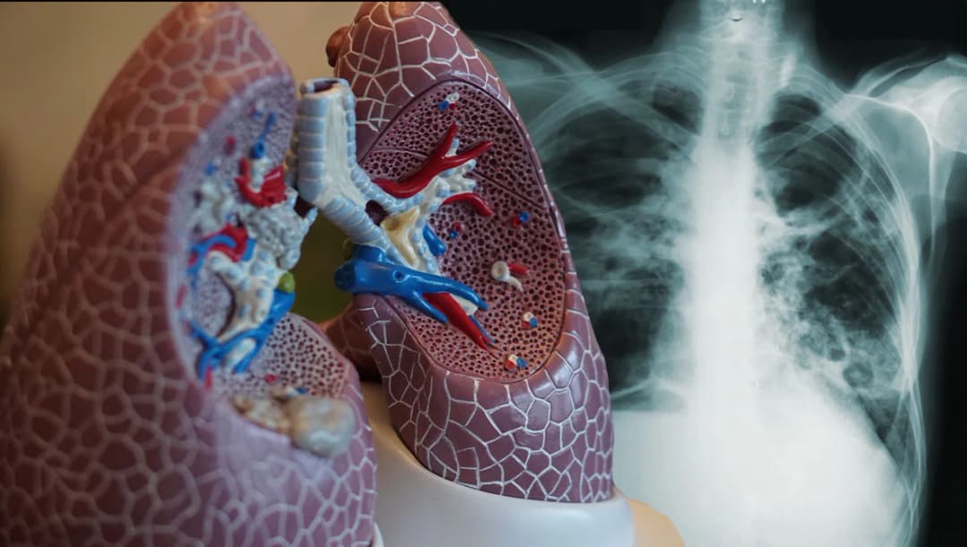 พิษฝุ่นจิ๋ว PM 2.5 ทำคนป่วยแล้ว 212,674 ราย 23 จังหวัดจ่อเปิดศูนย์ปฏิบัติการฯ รับมือ