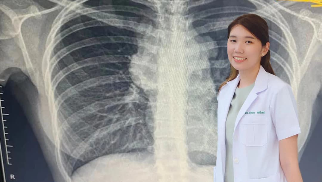 ‘พักก้อน’ เพจเล่าเรื่องราวจาก หมอสู้ ‘มะเร็งต่อมน้ำเหลือง’ จนโรคสงบ