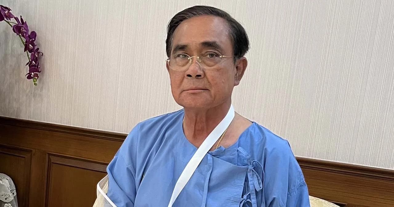 เปิดภาพล่าสุด พล.อ.ประยุทธ์ ต้องเข้าเฝือก นอนรพ. 1 คืน รักษามือขวาบวมอักเสบ