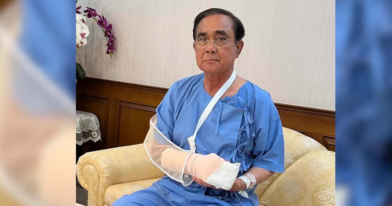 ผอ.รพ.พระมงกุฎฯ แถลงอาการมือขวา นายกฯ ไม่ใช่โรคเก๊าท์เทียม