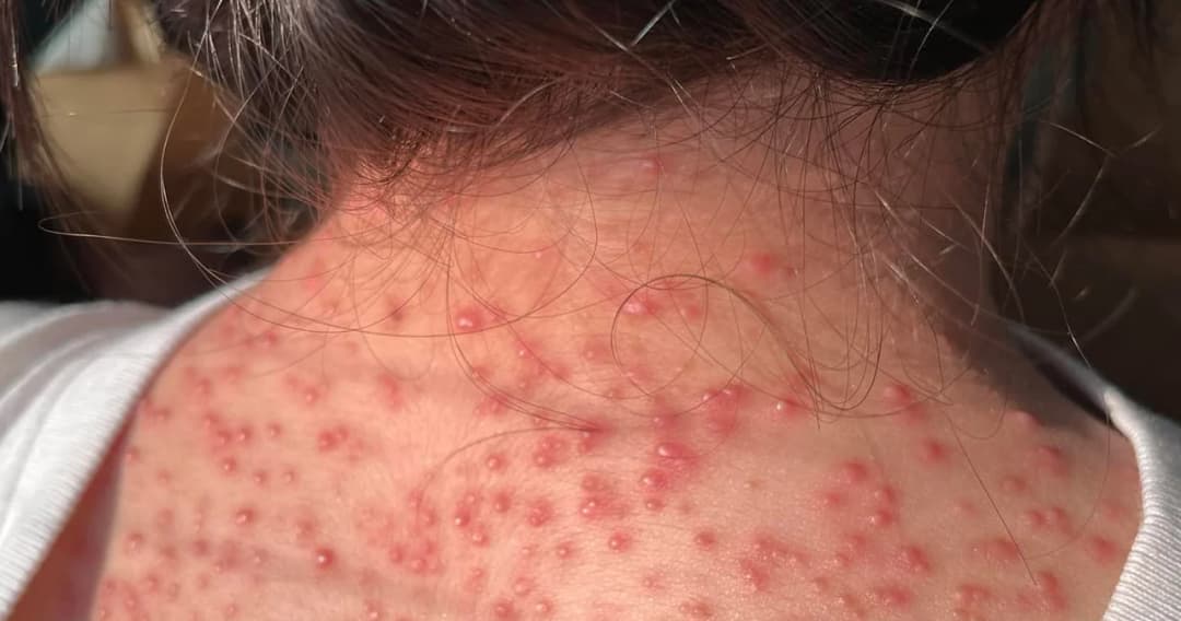 ‘ตะวัน’ ปล่อยภาพ ‘หยก’ เยาวชนที่ถูกคุมขังในคดี 112 หลังออกจากบ้านปรานีในวันนี้