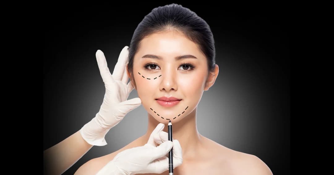 บูมศัลยกรรมตกแต่งใบหน้าเป็น Soft Power ยกโมเดลคนแห่ไปเกาหลีใต้รัฐหนุนพีอาร์ การตลาดจัดเต็ม