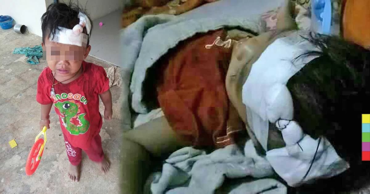 คืบหน้า ! เด็กกับแม่ถูกสุนัขมีเจ้าของไล่กัดจนรถล้มบาดเจ็บ เจ้าของสุนัขรับผิดชอบแล้ว