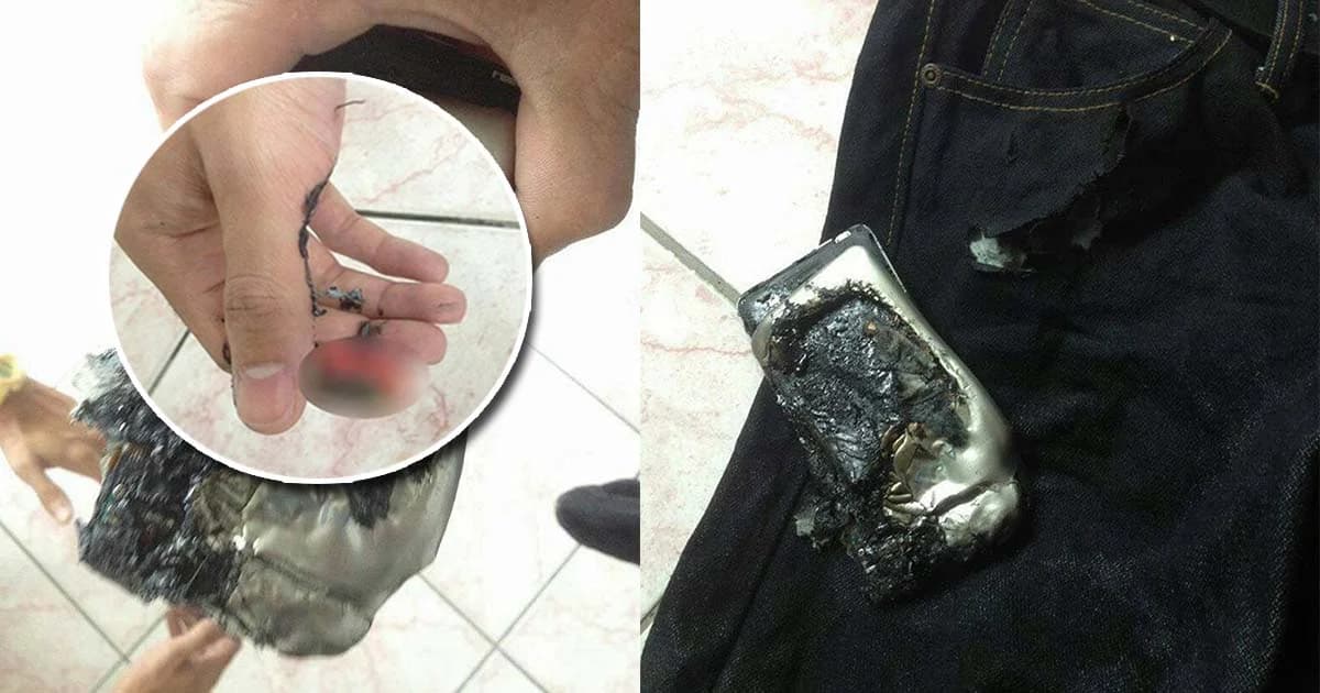 แตกตื่นทั้งมหาวิทยาลัย ! มือถือละลายไหม้ติดกางเกง นศ. คาห้องสอบ