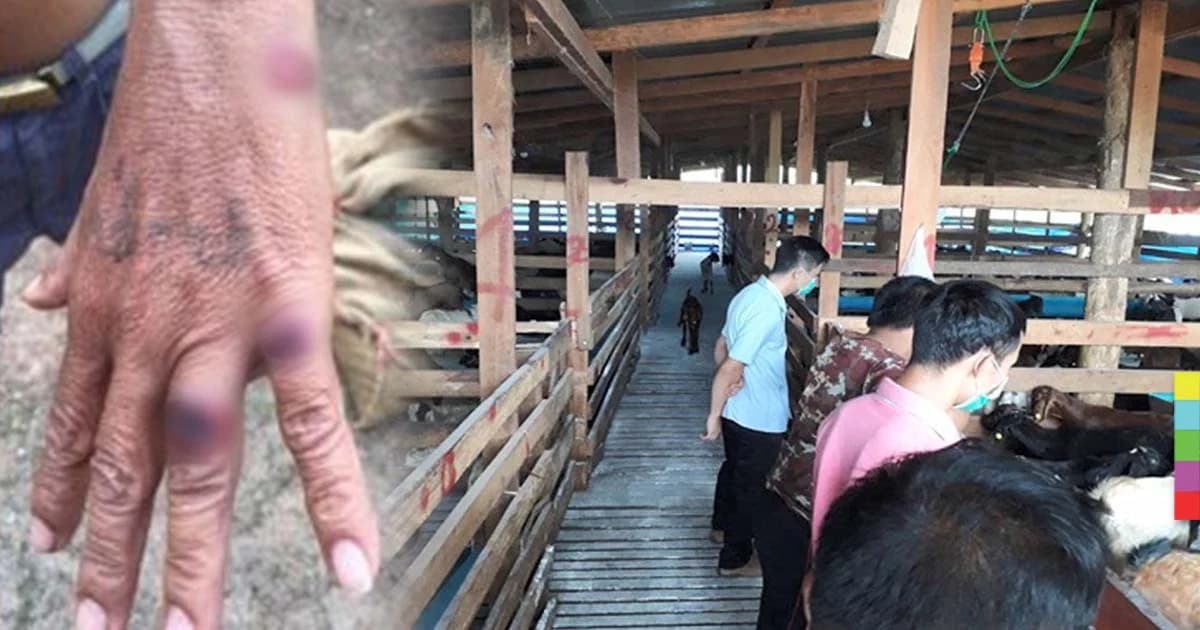 แพทย์ไม่ยืนยัน กินเนื้อแพะป่วยเป็น “โรคแอนแทรกซ์”