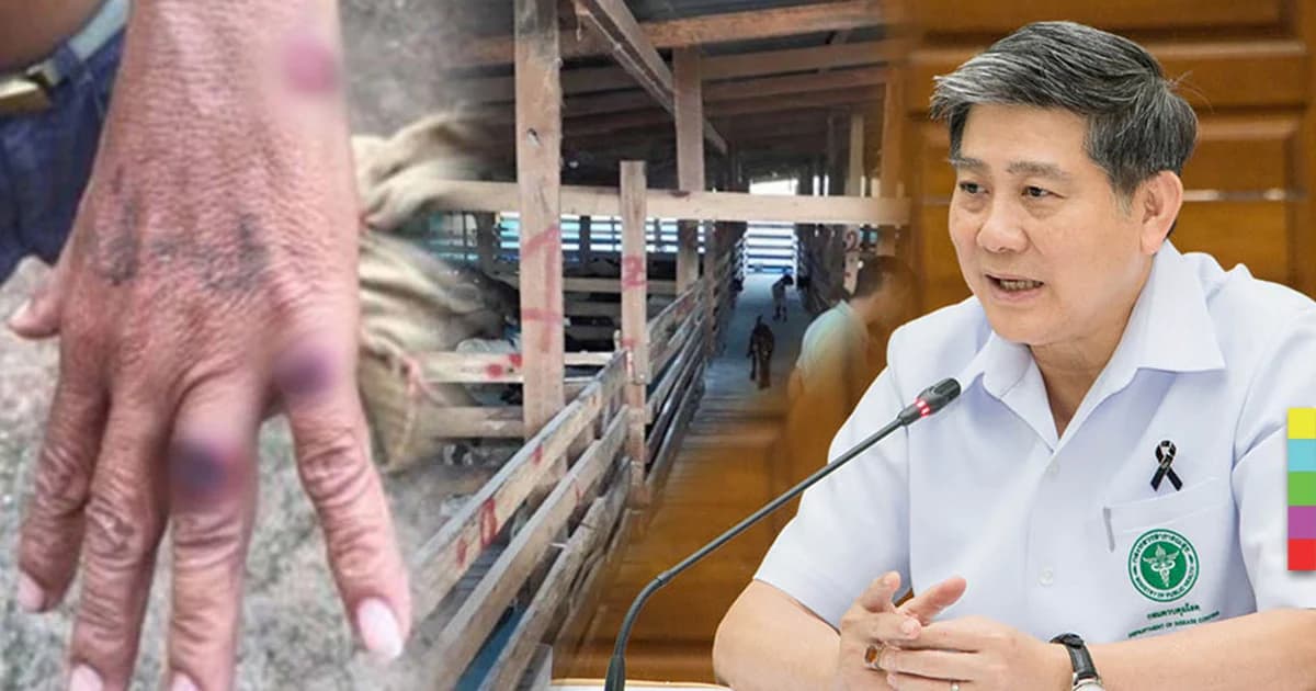 สธ.ยัน ‘โรคแอนแทรกซ์’ ไม่ระบาดในไทย-ไม่ติดต่อคนสู่คน