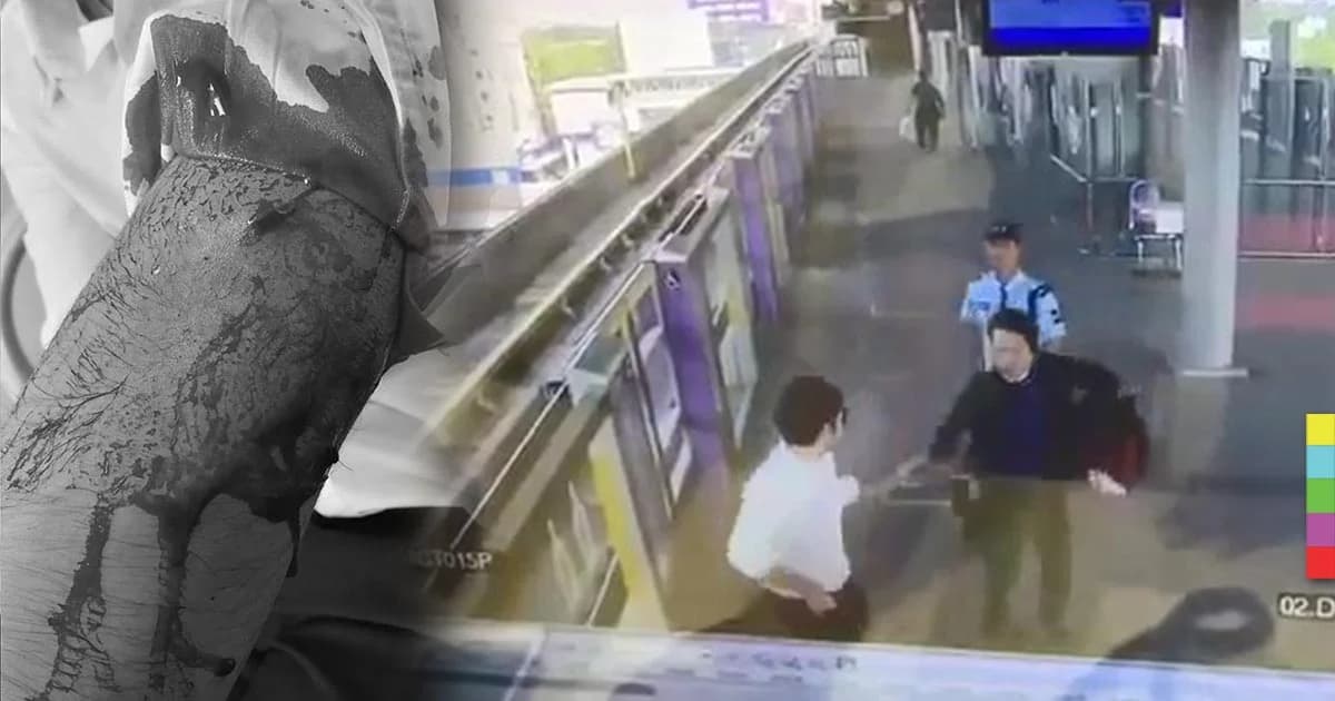 รฟม. ยัน รปภ.ทำตามคู่มือ เหตุหนุ่มโดนเข็มขัดฟาดเลือดอาบ