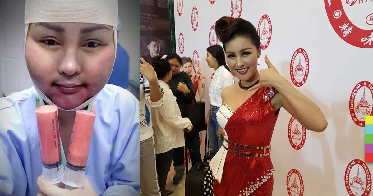 “หญิงลี” รับ ผ่าตัดศัลยกรรม 4 ครั้ง ไม่เครียด ผมร่วงเกือบหมดผลข้างเคียงจากการรักษา