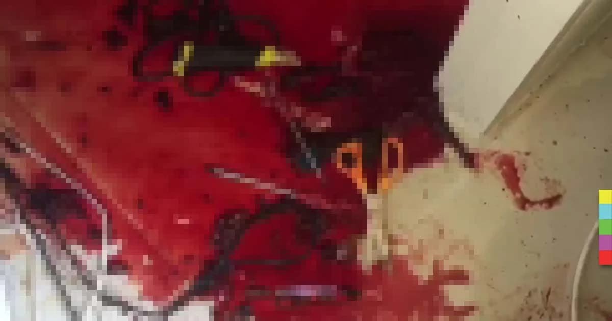 หนุ่มนักศึกษาเล่นเกมหลอน คว้ากรรไกรแทงตัวเองเจ็บ