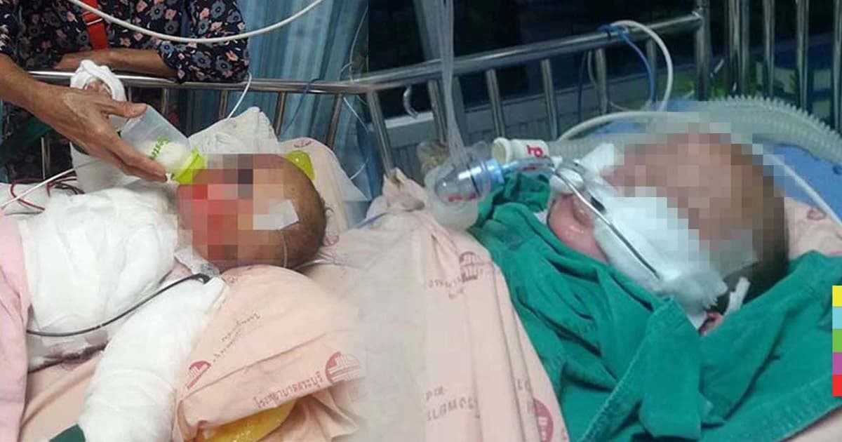 พิเรนทร์จนได้เรื่อง ! เด็กหัดทำระเบิดขวด พลาดไฟลามโดนตัวเด็กขวบเศษ