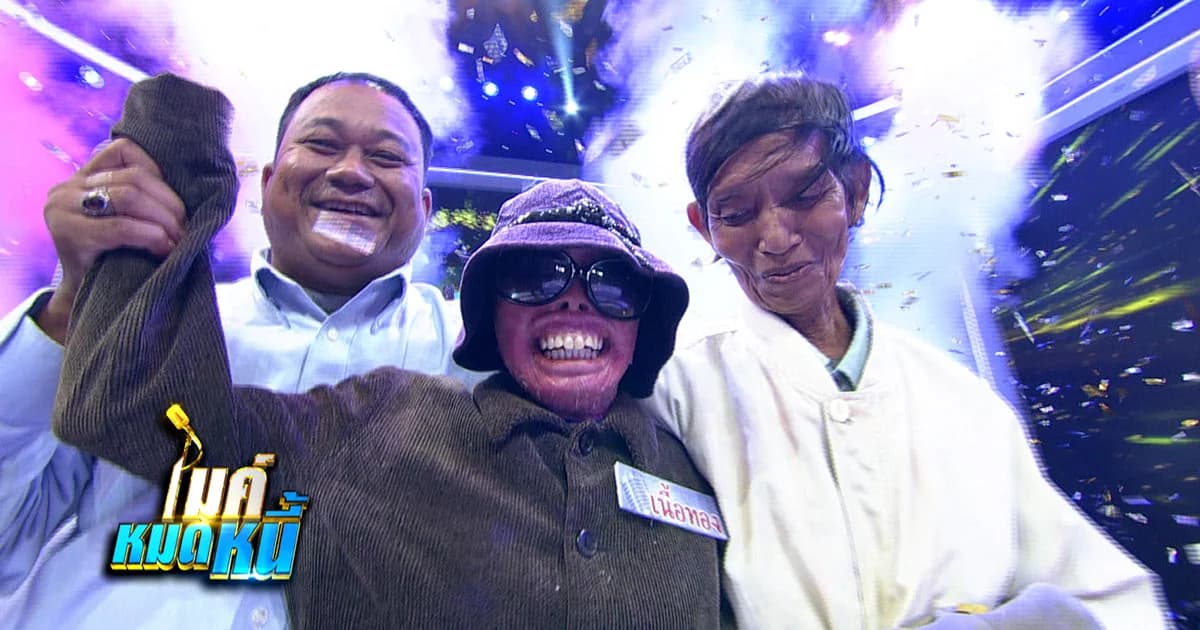 “เนื้อทอง” สาวไร้ผิวหนังสู้ด้วยหัวใจ ทำความฝันหมดหนี้เพื่อพ่อสำเร็จ