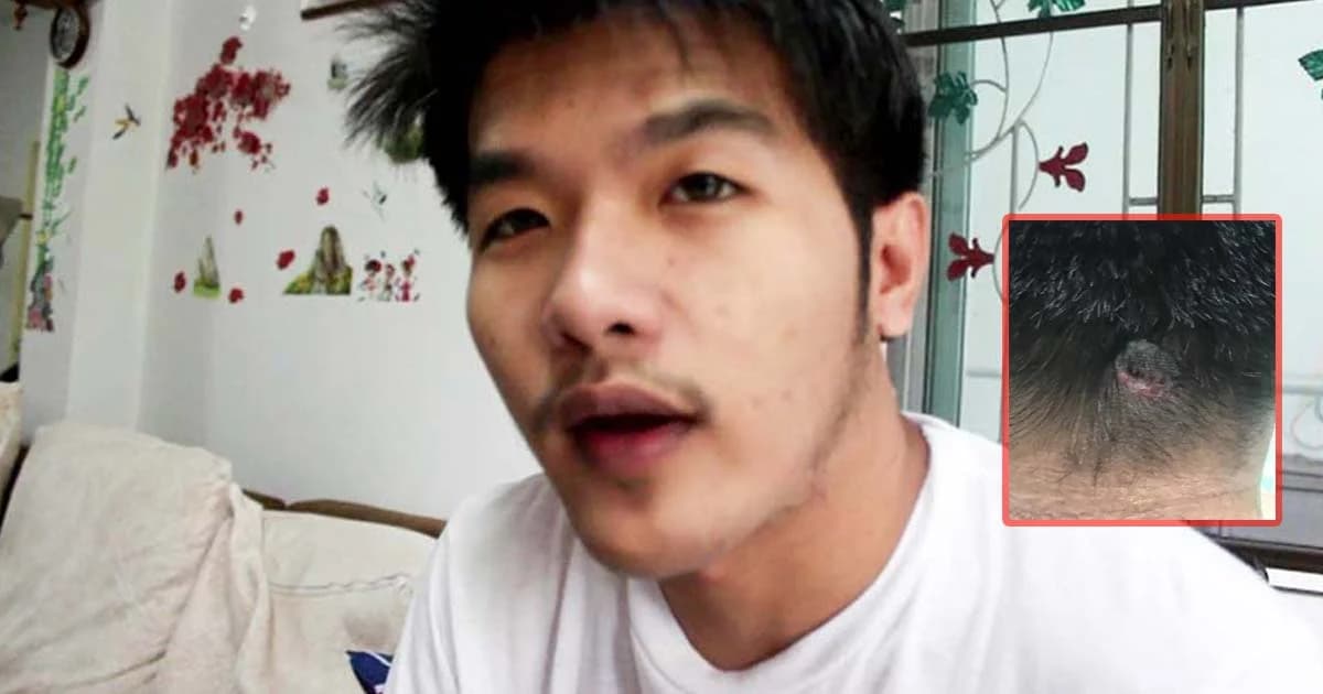 หนุ่มถูกยิงผิดตัว กระสุนยังฝังหัว รูปคดีเงียบ ไร้คนเยียวยา