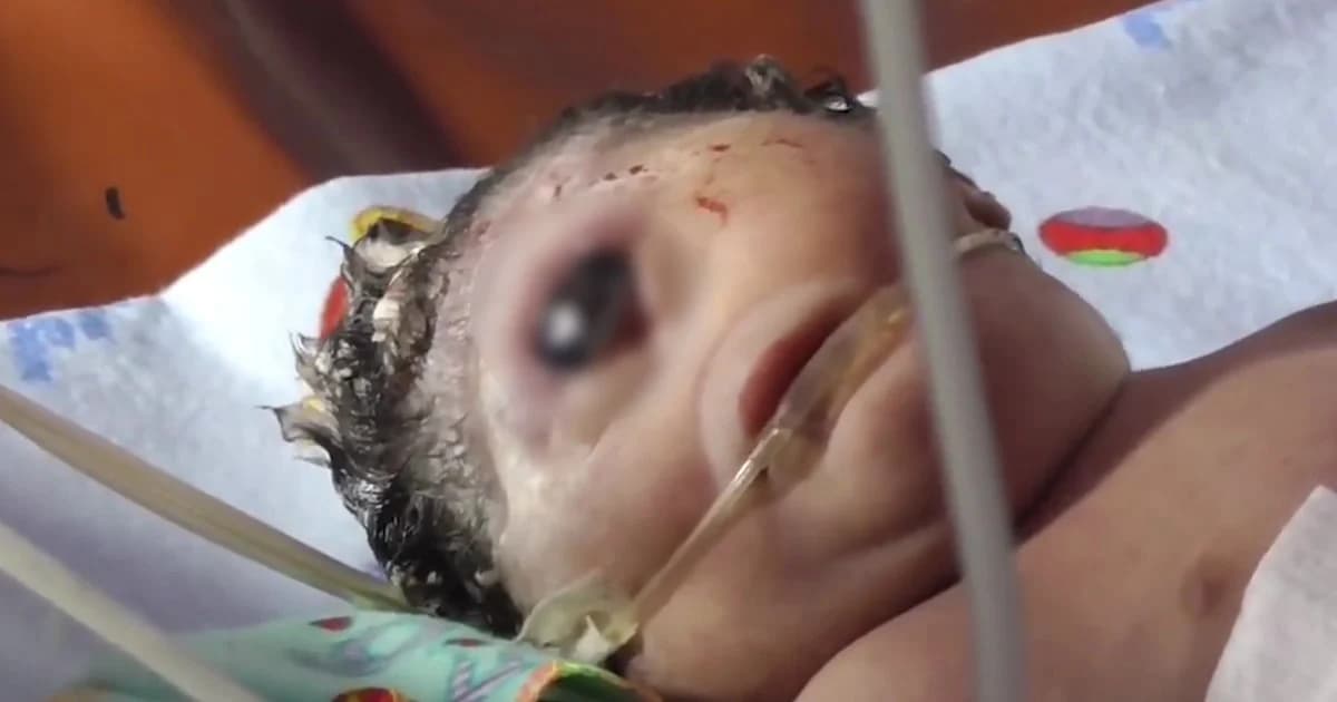 เศร้า! ลูกเกิดมามีตาเดียว-ไม่มีจมูก ก่อนเสียชีวิต หลังลืมตาดูโลกเพียง 7 ชม.