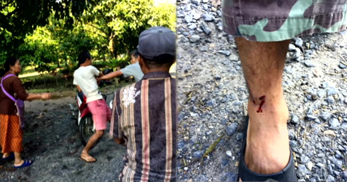 หนุ่มปืนโหด! ยิงขา-ฟันหัว เพื่อนบ้านสาหัส