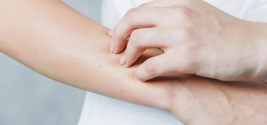 อ่อนเพลีย มีไข้ ปวดข้อ ผมร่วง มีแผลในปาก เสี่ยงป่วยโรคแพ้ภูมิตัวเอง