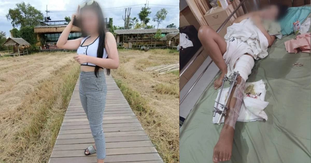 หญิงสาวถูกกระสุน M16 เจ้าหน้าที่ยิงผิด หมอรับขาอาจไม่เหมือนเดิม