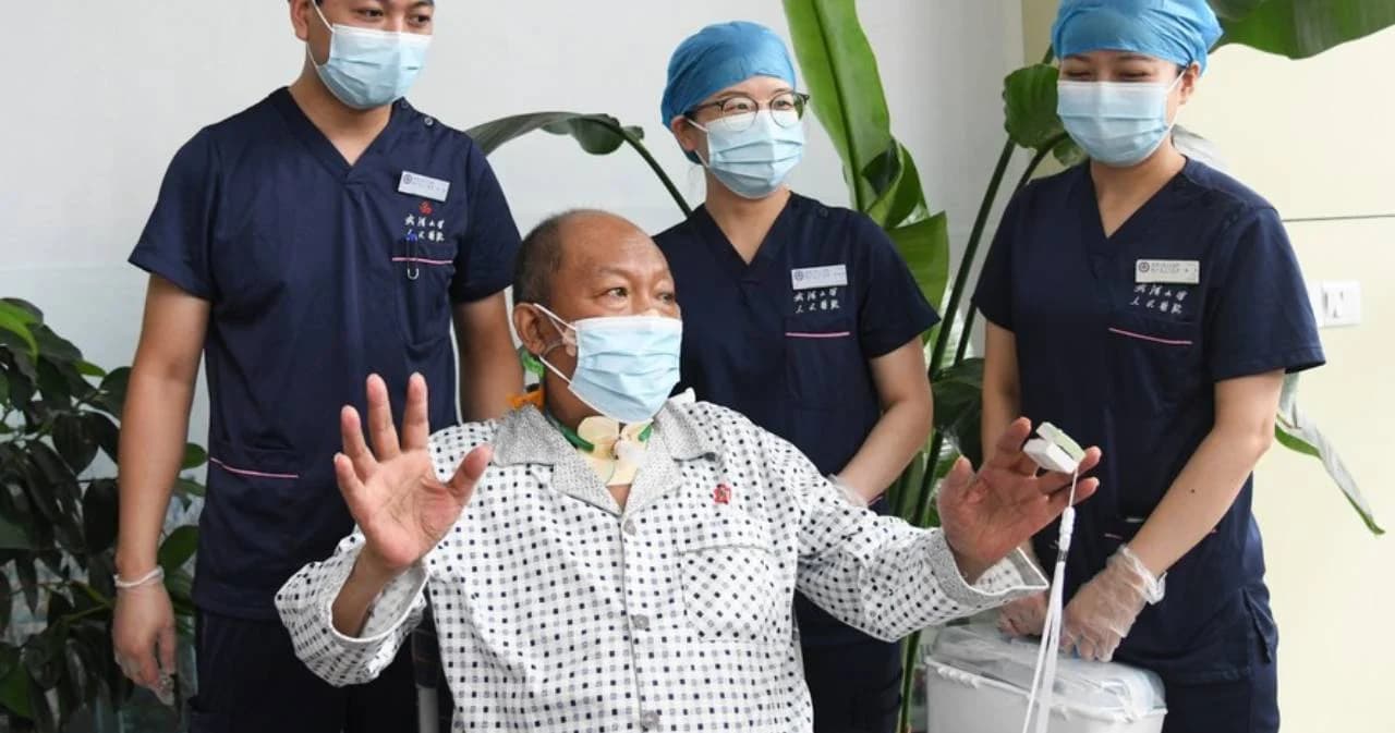 ลุงชาวจีนวัย 65 ปี ป่วยโควิดต้องเปลี่ยนถ่ายปอด คนแรกของโลกที่ออกจาก รพ.ได้