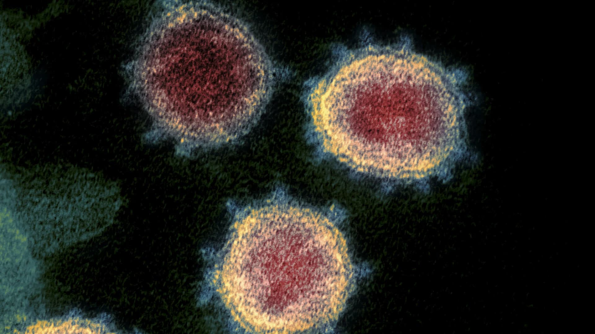 ระยองพบผู้ติดเชื้อโควิด-19 วันเดียว 27 ราย โยงบ่อนการพนัน เข้มอำเภอเมืองพื้นที่ควบคุมสูงสุด