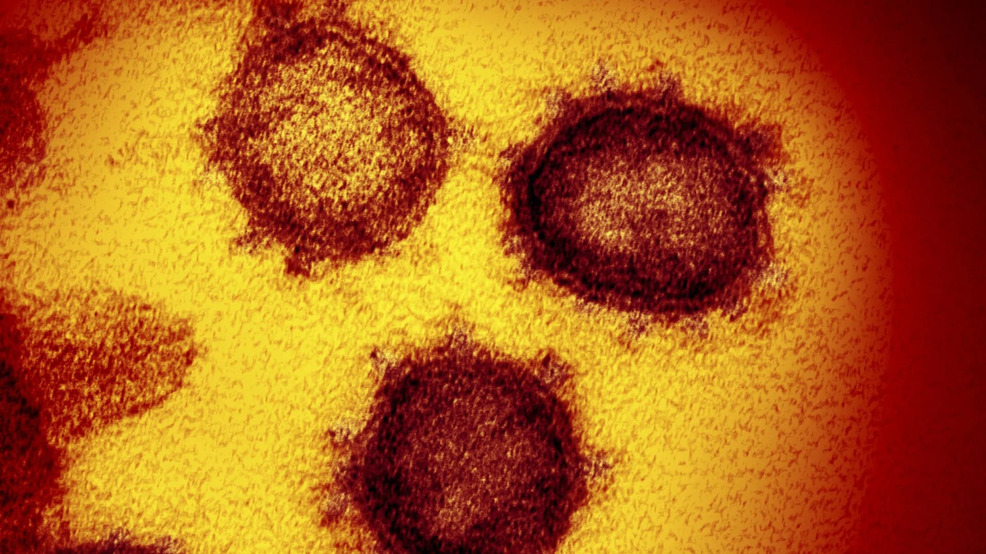 องค์การอนามัยโลกประเมินว่า ภูมิคุ้มกันหมู่โควิด-19 อาจเกิดขึ้นไม่ทันปีนี้