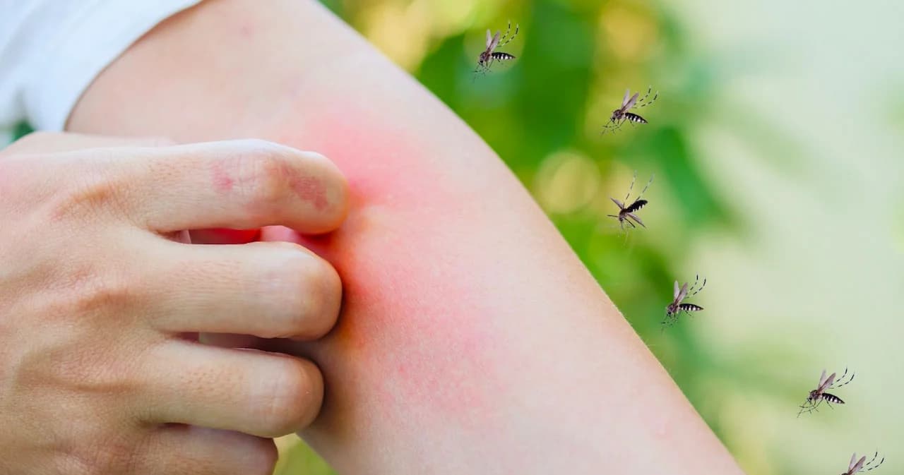 แพทย์แนะฉีดวัคซีนก่อนป่วย ไข้เลือดออกรุนแรง หลังคนไทยป่วยทะลุแสน 2 ปีซ้อน