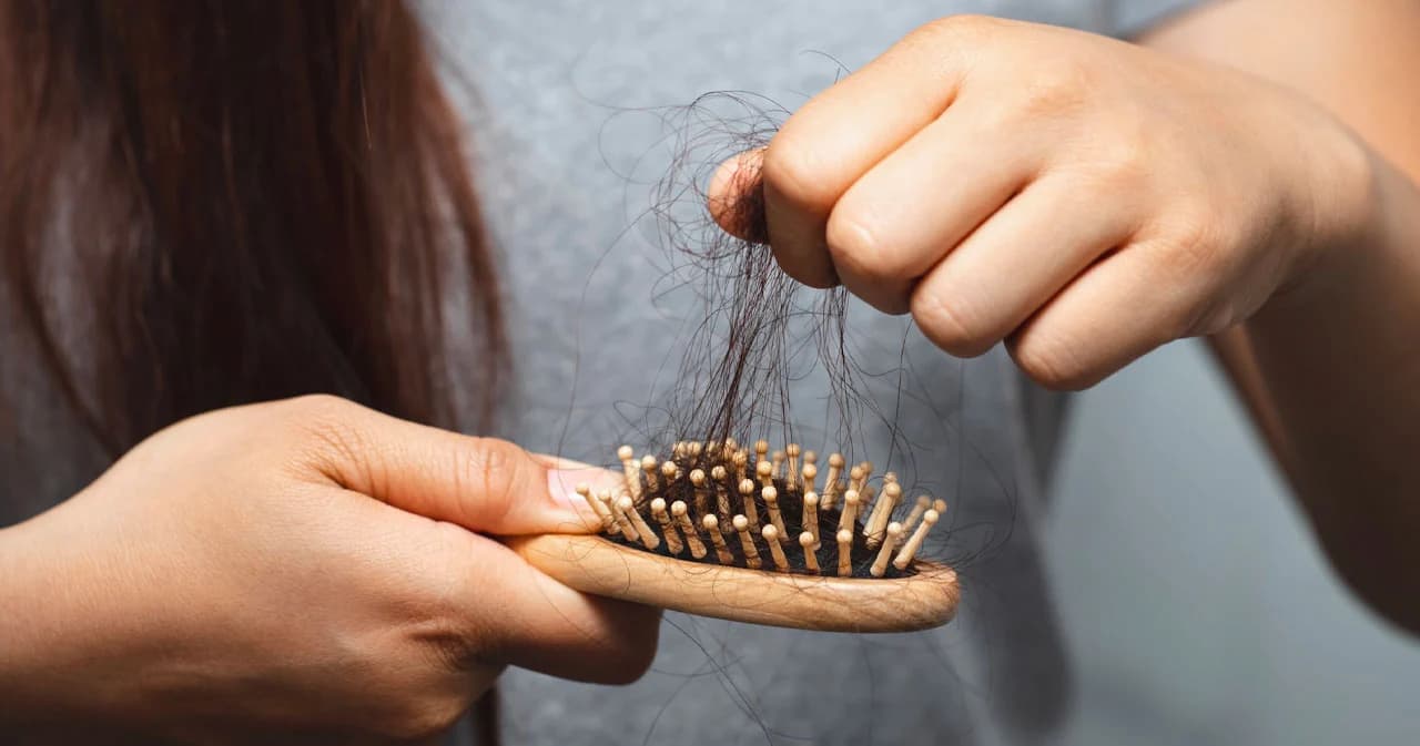 ปัญหาใหญ่วัยทำงาน ยิ่งเครียดยิ่งผมร่วง แนะรีบพบแพทย์-หาสาเหตุ ก่อนผมบางถาวร